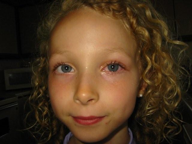 Pink eye symptoms picture. Bobbi Brown - Eye Shadow - #43 Baby Pink ( New
